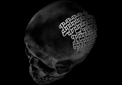 stahlmann pro - Stahlmann Pro | Surgical, Spine & Trauma Implants Manufacturer -