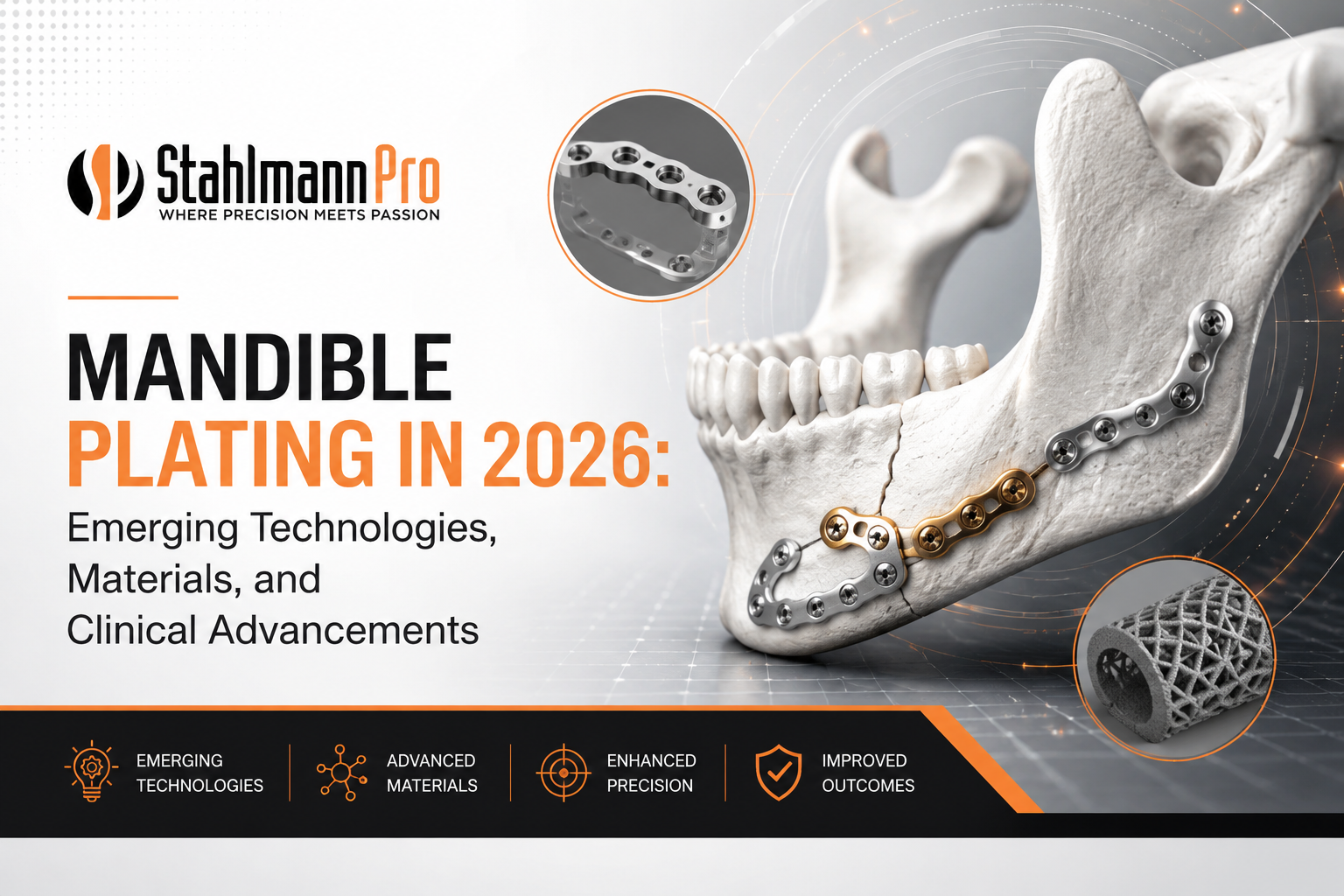 Mandible Plating in 2026